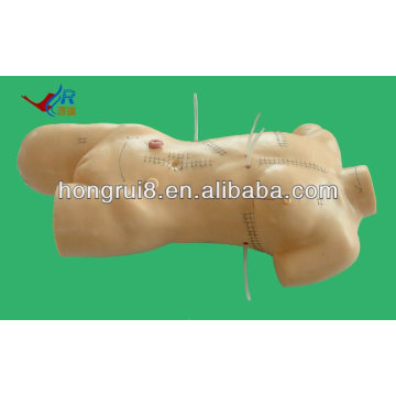 ISO Advanced Surgical Suturing and Bandiating Model, Лечение рака